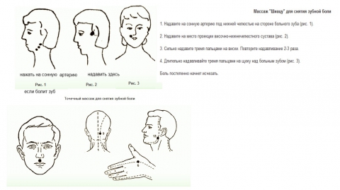 Точки на теле от зубной боли показать картинки